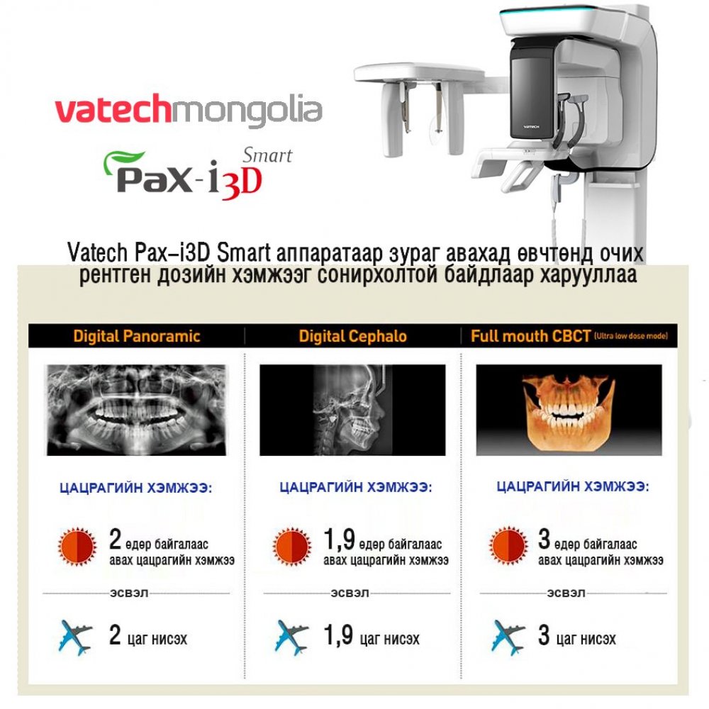 Pax-i 3D Smart аппарат рентген доз хир их ялгаруулдаг вэ? 