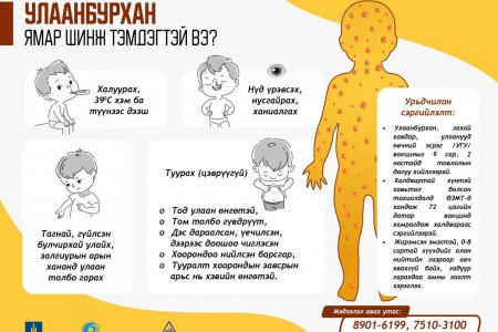 УЛААНБУРХАН ӨВЧНӨӨС  ХАМТДАА СЭРГИЙЛЬЕ.