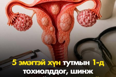 5 эмэгтэй тутмын 1 нь мэдэлгүй өнгөрдөг 