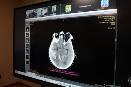 Иргэд орон нутагтаа рентген, СТ, MRI, МАМОГРАФИК дүрс оношилгоог хийлгэх боломжтой боллоо.