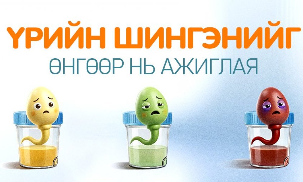 Үрийн шингэний өнгө яагаад чухал вэ?