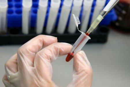 ДОХ-ын 252 тохиолдол бүртгэгджээ