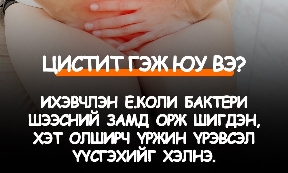 Цистит гэж юу вэ?