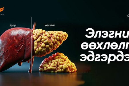 Элэгний өөхлөлт эдгэрдэг