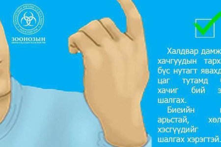 Хачиг хэдий жижиг ч нэг л хазалтаар аюулт өвчнийг дамжуулдаг