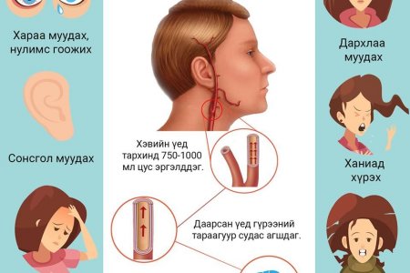 НЭМҮТ: Хүйтэнд малгай өмсөхгүй байснаар мэдрэлийн суурь өвчин үүсэх, ой тогтоолт муудах зэрэг аюултай