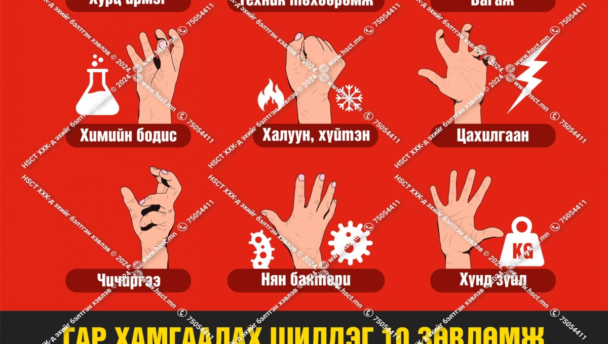 Хуруу, гар гэмтлийн нийтлэг шалтгаанууд B1B16 | Гараа хамгаалах ...