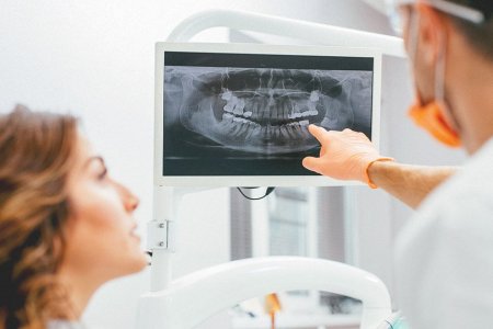 Шүдний рентген зураг авах үед хэр хэмжээний цацраг ялгардаг вэ?