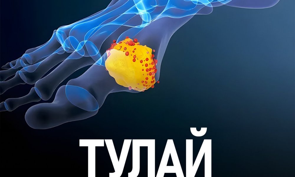 Тулай өвчний тухай хүмүүсийн мэддэггүй баримтууд