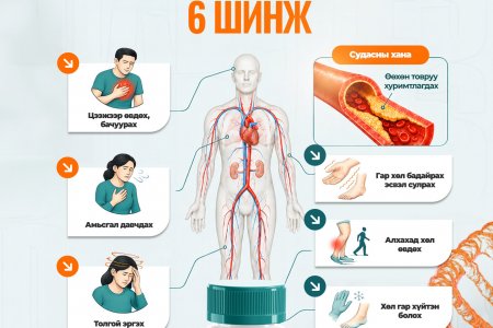Судас хатуурсныг илтгэх 6 шинж