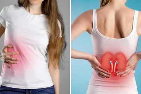 Бөөр сийрэгжсэн гэдэг хариу  хэвлийн эхо шинжилгээгээр гарсан уу?  Энэ бол архаг пиелонефрит өвчний үеийн хэвлийн ЭХО шинжилгээний хариу юм.