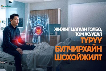 Нуугдмал аюул: Түрүү булчирхайн шохойжилт гэж юу вэ?