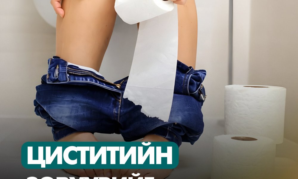 Циститийн өвдөлтийг хурдан намдаах арга