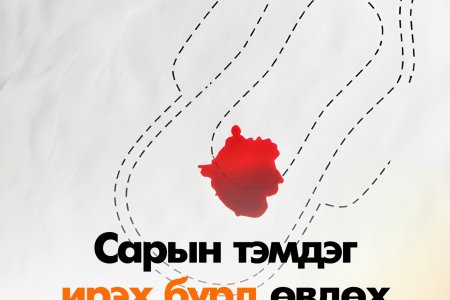 Сарын тэмдгийн өвдөлт намдаах аргууд