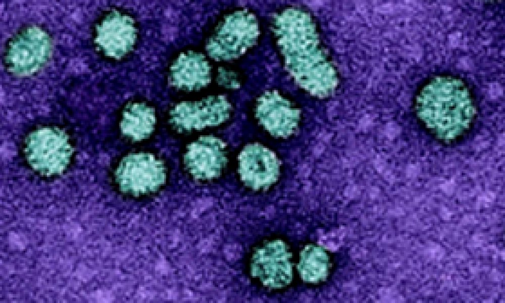 Та В вирусээр оношлогдсон ч “зовуурь алга” гэж тоохгүй яваа юм биш биз?