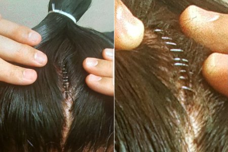 Таканоивагийн ах дүүгийнхээ толгойд тавиулсан оёдлын зургийг дэлгэлээ