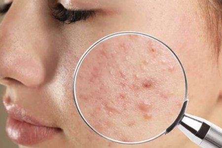 Хэт Батгашилттай Арьс  Арчилгааны Зөвлөгөө 