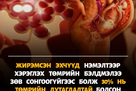 Жирэмсэн үедээ ямар төмөр сонгох вэ?