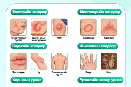 Арьсны үрэвслийн төрлүүд 