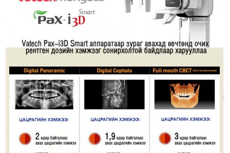 Pax-i 3D Smart аппарат рентген доз хир их ялгаруулдаг вэ? 