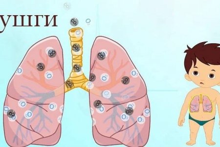 Хатгалгаа өвчний шинж тэмдгийг таних, урьдчилан сэргийлэх аргууд