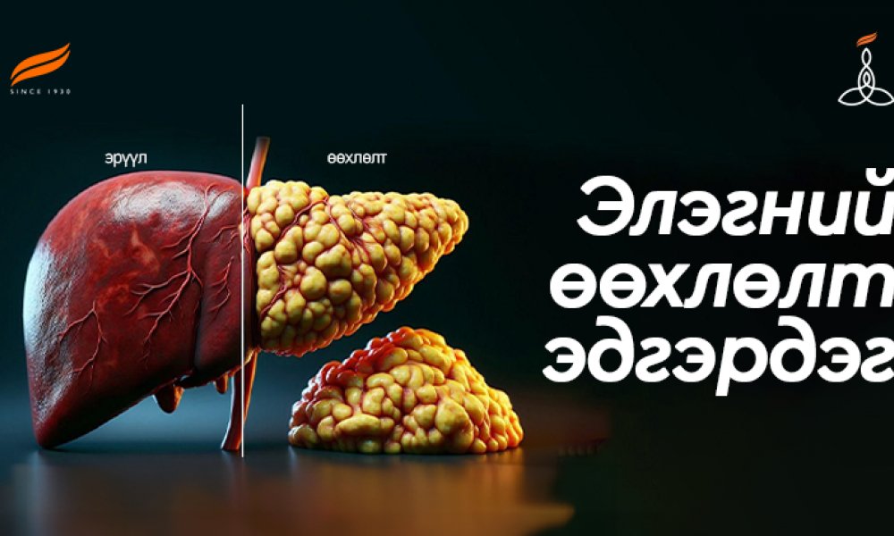 Элэгний өөхлөлт эдгэрдэг