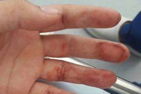 Эхнэр маань гараа урагдтал төрхийн сандал дээр тэмцэж, эцэст нь үрээ алдлаа