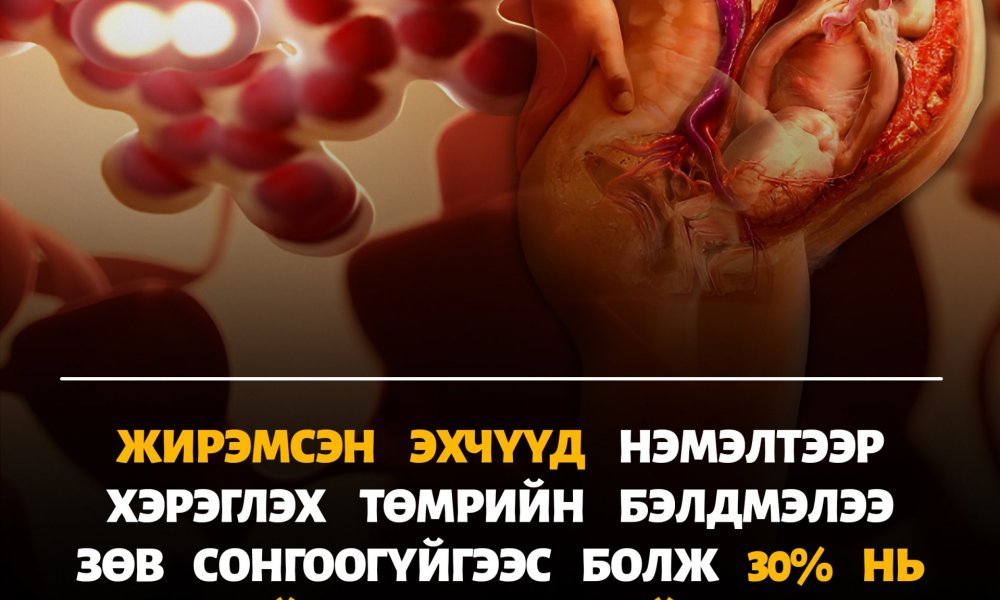 Жирэмсэн үедээ ямар төмөр сонгох вэ?