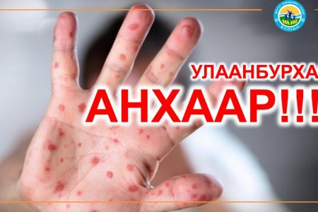 УЛААНБУРХАН ӨВЧНИЙ ТОХИОЛДОЛ БҮРТГЭГДЛЭЭ. 