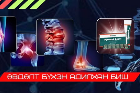 Өвдөлт бүхэн адилхан биш