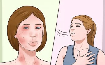 Харшлын сорил тавиулахаас 72 цагийн өмнө харшлын эм ууж болохгүй