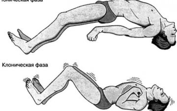 Хөнгөлөлттэй эмийн жагсаалтаас зарим нэр төрлийн эм хасагдсан нь иргэдэд хүндрэлтэй байна