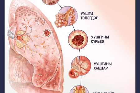 Таны уушгинд тусламж хэрэгтэй байгааг илтгэх 5 шинж 