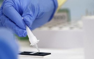 Шинжилгээ өгсөн 200 хүний 50-60 нь халдвартай байгаа учраас шаардлагагүй бол шинжилгээний цэгт ирэхгүй байхыг анхаарууллаа