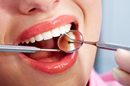 Шүд цэвэрлэгээ гэж юу вэ?