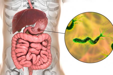 Ходоодны шарх өвчний 91% -д Хелико пилори бактери илэрдэг