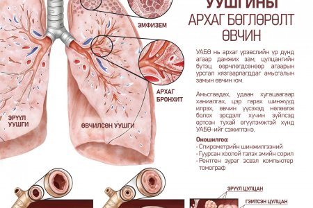 Шатаар өгсөхөд амьсгал давчдах, амьсгаадах нь уушгины архаг бөглөрөлт өвчний шинж