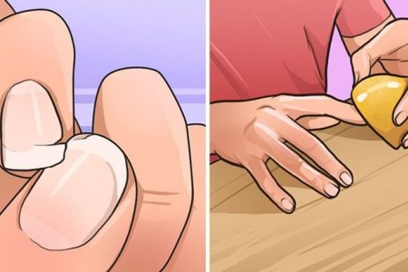 Таны хумс давхар ургаад хугарч гэмтээд байна уу?