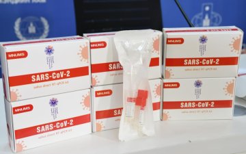 ЭМЯ “КОВИД-19”-ийн халдварыг шүлснээс илрүүлэх 10 мянган ширхэг оношлуурыг хүлээн авлаа