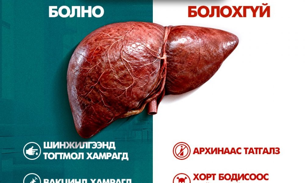 Элгээ хамгаалах энгийн аргууд