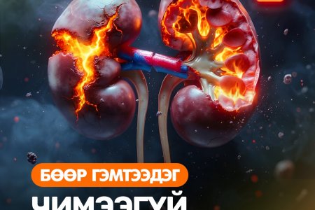 Бөөрийг чимээгүй гэмтээдэг зуршлууд