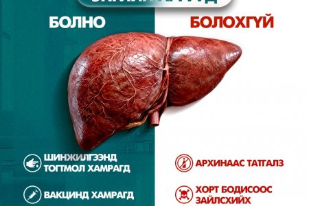 Элгээ хамгаалах энгийн аргууд