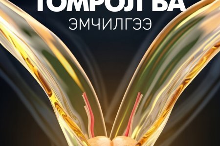 Түрүү булчирхайн томролын эмчилгээ