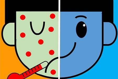 Улаанбурхан, улаанууд өвчний эсрэг нэмэлт дархлаажуулалт өнөөдөр эхэлж байна