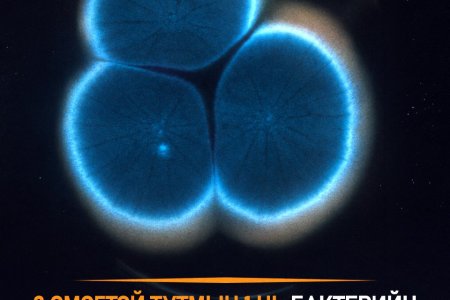Үтрээний үрэвсэл: Шалтгаан ба шинж тэмдэг