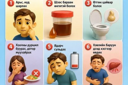 Вируст гепапитын халдварын илрэх шинж тэмдэгүүд: