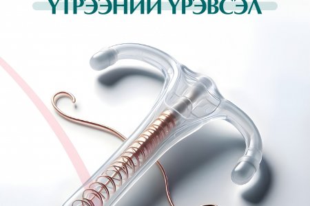 Ерөндөг тавиулсны дараах үтрээний үрэвсэл