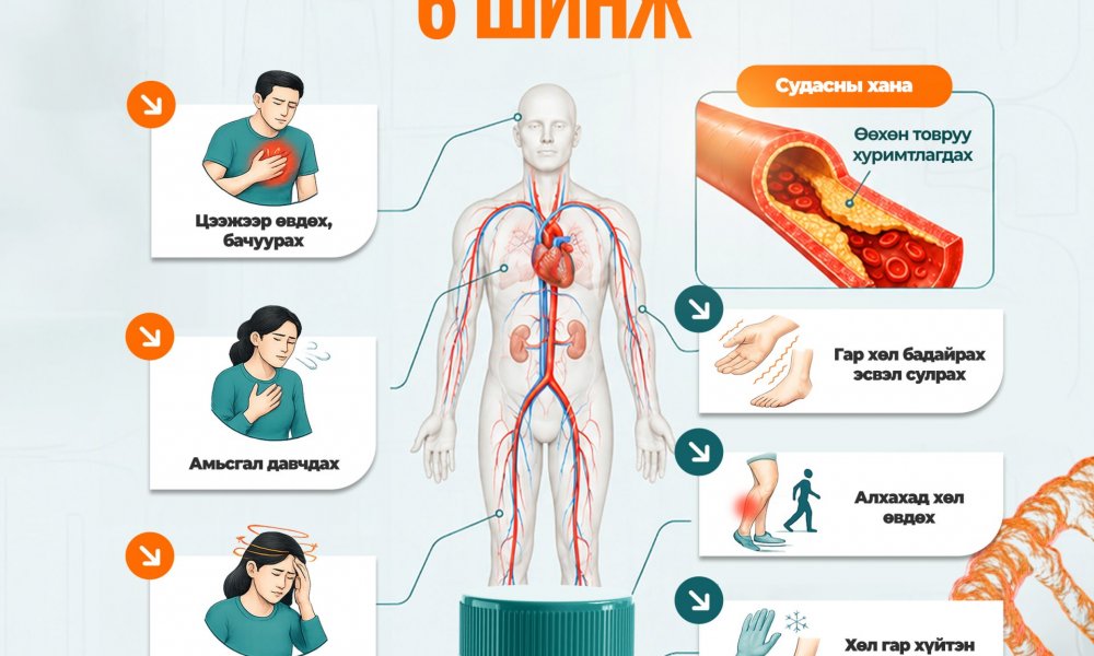 Судас хатуурсныг илтгэх 6 шинж