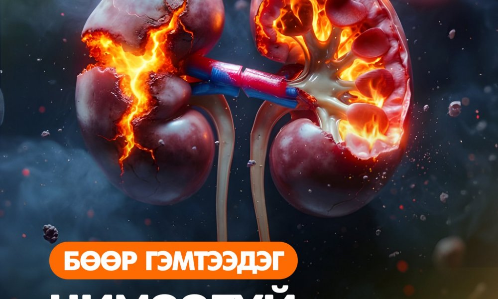 Бөөр гэмтээдэг зуршлууд