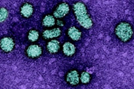 Та В вирусээр оношлогдсон ч “зовуурь алга” гэж тоохгүй яваа юм биш биз?